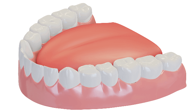 Dental crowns and bridges allow dentists to protect and restore damaged teeth. Typically, when tooth decay is severe enough that it can’t be treated with a filling, a dental crown will be used to cover, or cap, the tooth. Crowns are also commonly used to seal teeth that have been treated with root canal therapy. And occasionally, dental crowns from our Placentia office are used for cosmetic purposes or in smile makeovers. A dental bridge is a type of dental work that replaces a tooth or a few consecutive missing teeth. Two dental crowns are placed on the healthy teeth living on either side of the gap left by your lost tooth. A false tooth, or pontic, is attached to the crowns and literally bridges the gap, replacing your missing tooth.